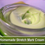 Homemade Stretch Mark Cream